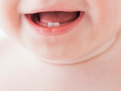 La poussée dentaire chez bébé